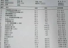 肝功能检查显示一切正常，怎么就肝硬化了！？